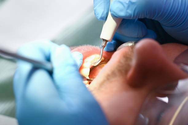 Best Emergency Treatment for Oral Infections in Fobes Hill, WA