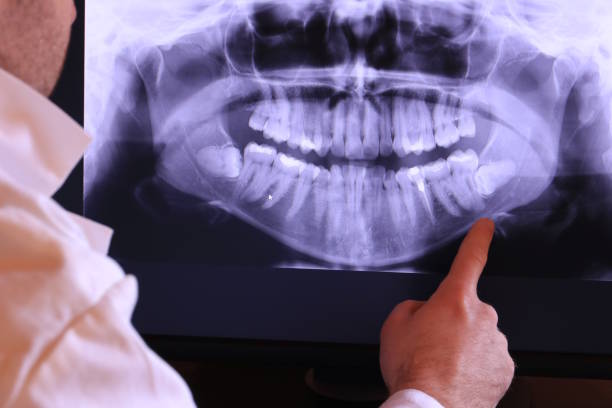 Best Emergency Treatment for Jaw Pain or Injury in Fobes Hill, WA